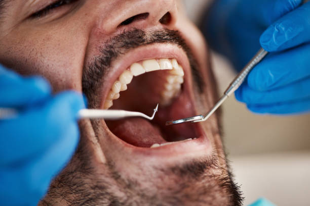 Best Emergency Dentist for Knocked-Out Tooth in Freedom, PA